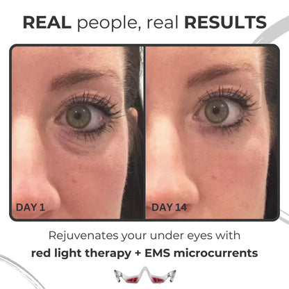 Red Light Anti Ageing 3D Eye Therapy